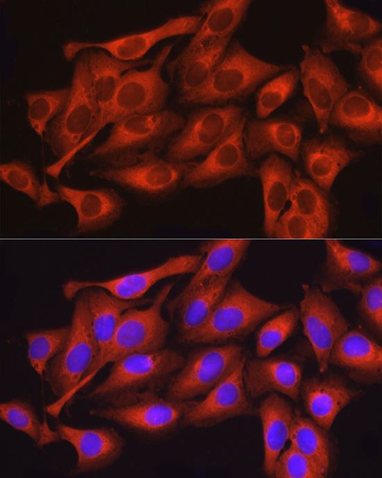Anti-Dynamin 2 Rabbit pAb