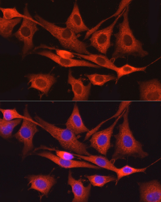 Anti-Dynamin 2 Rabbit pAb