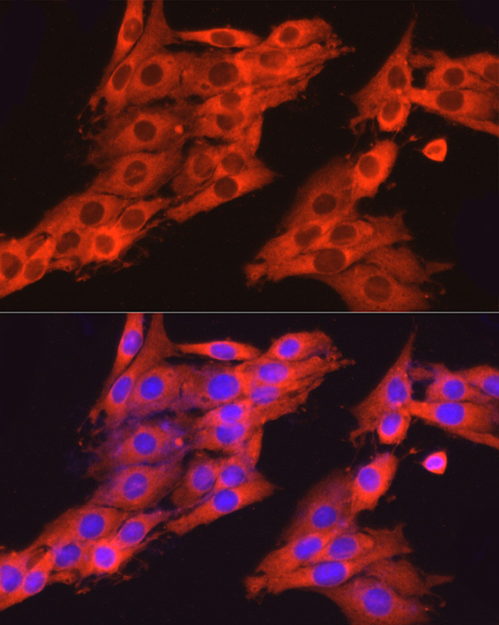 Anti-Dynamin 2 Rabbit pAb