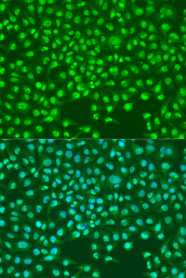 Anti-SKP2 Rabbit pAb