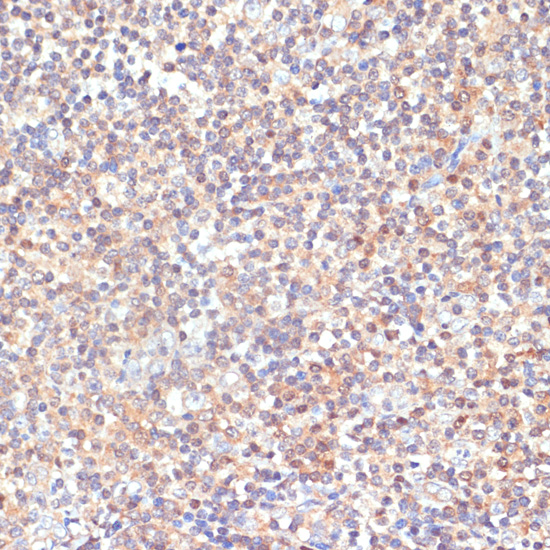 Anti-PKC delta Rabbit pAb