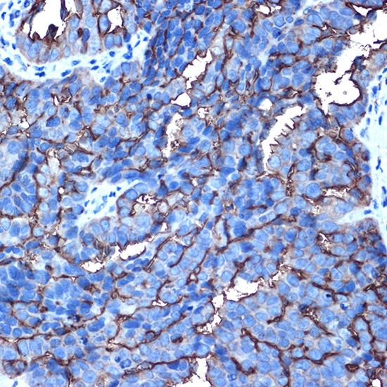 Anti-Mucin 1 Rabbit pAb