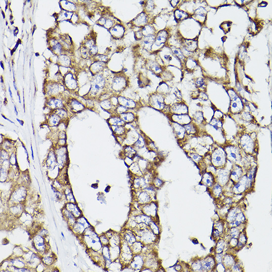 Anti-PDIA1 Rabbit pAb