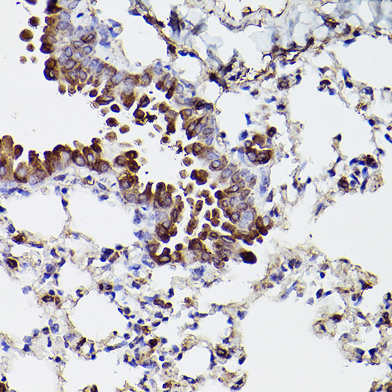Anti-PDIA1 Rabbit pAb