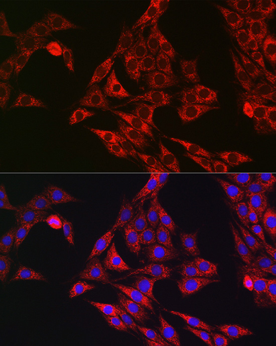 Anti-PDIA1 Rabbit pAb