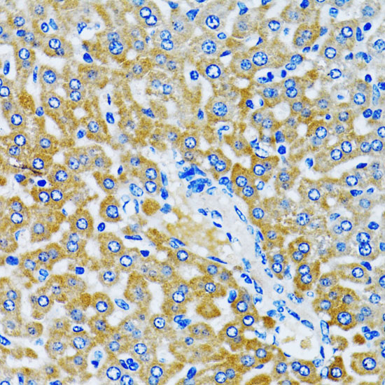 Anti-HDAC5 Rabbit pAb