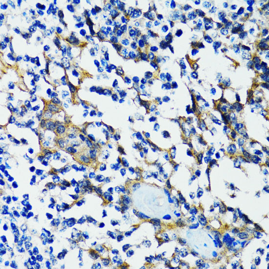 Anti-HDAC5 Rabbit pAb