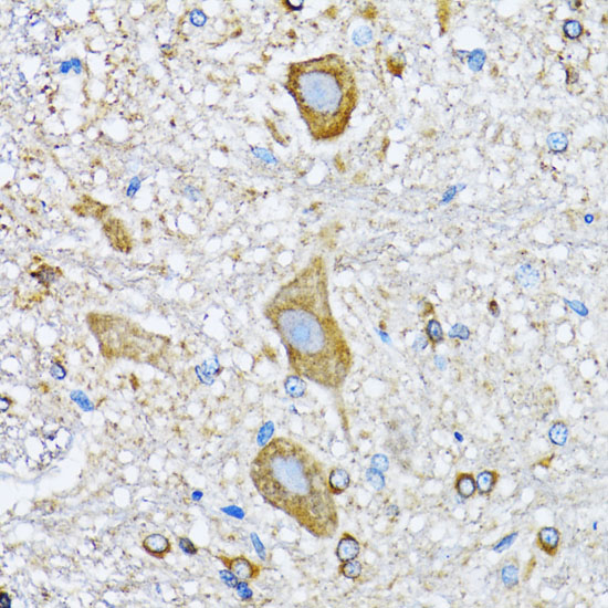 Anti-HDAC5 Rabbit pAb