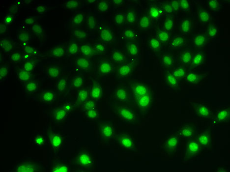 Anti-HDAC5 Rabbit pAb
