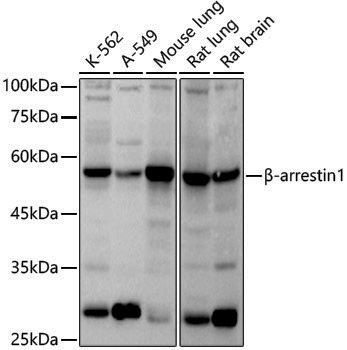 Anti-beta Arrestin 1 Rabbit pAb