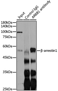 Anti-beta Arrestin 1 Rabbit pAb