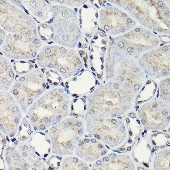 Anti-CEBP Beta Rabbit pAb