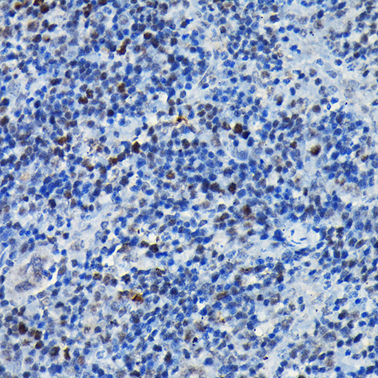 Anti-CEBP Beta Rabbit pAb