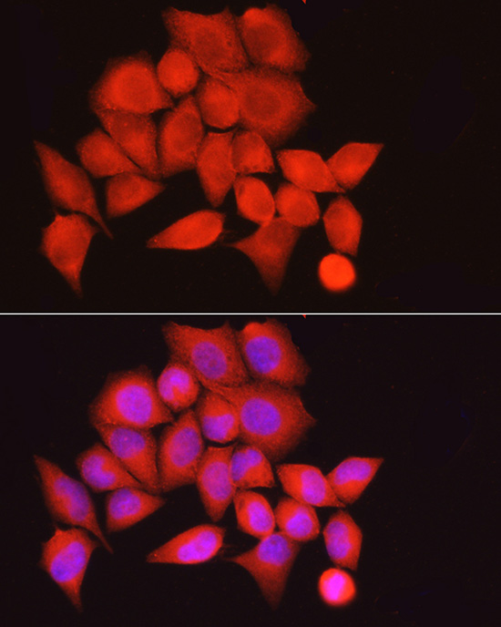 Anti-MYPT1 Rabbit pAb