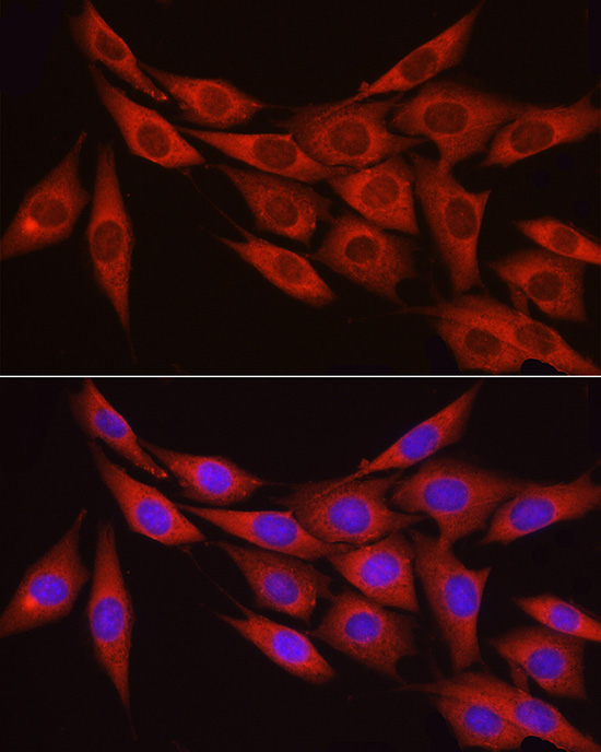 Anti-MYPT1 Rabbit pAb