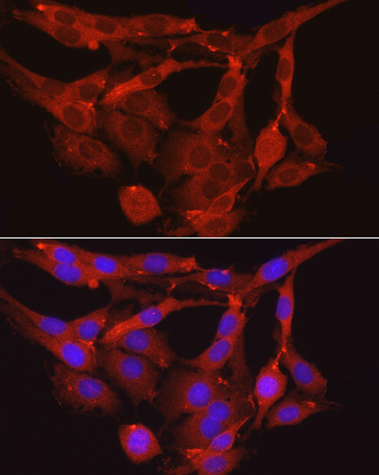 Anti-MYPT1 Rabbit pAb