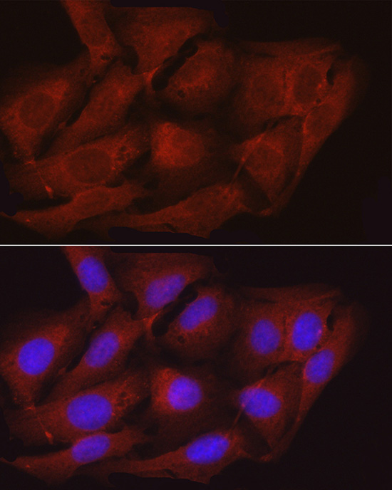 Anti-MYPT1 Rabbit pAb
