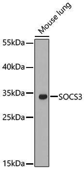 Anti-SOCS3 Rabbit pAb