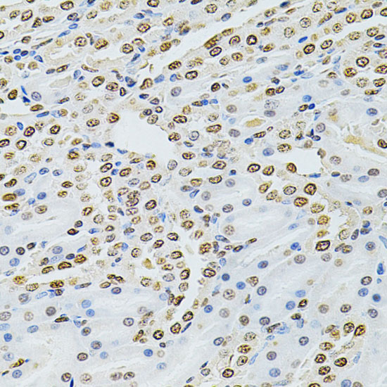 Anti-Integrin Linked ILK Rabbit pAb