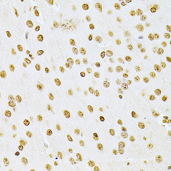 Anti-Integrin Linked ILK Rabbit pAb