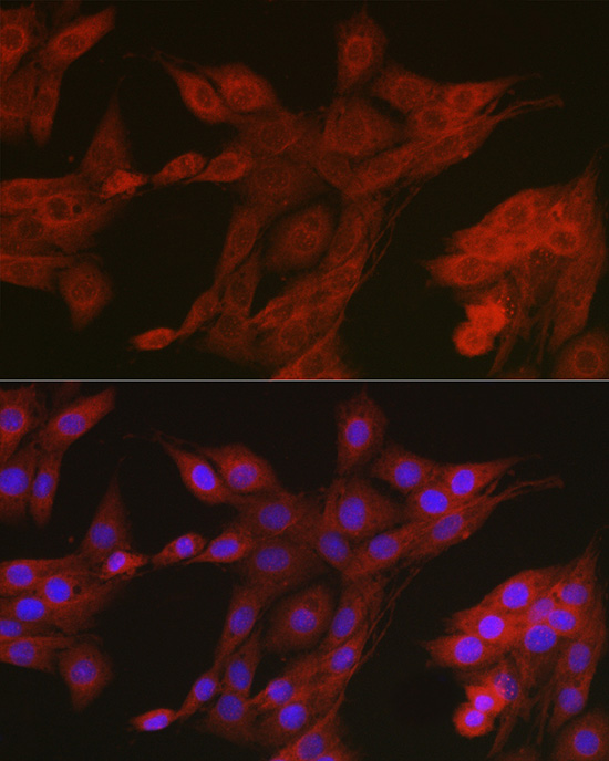 Anti-AMPK alpha 2 Rabbit pAb
