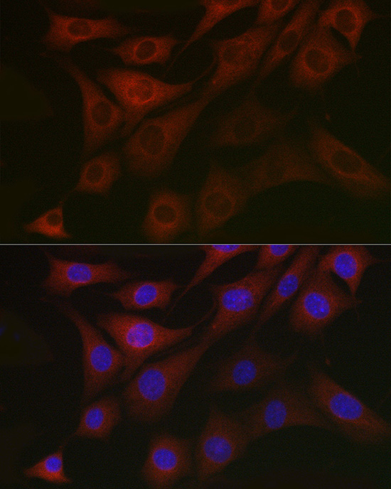 Anti-PDK1/PDHK1 Rabbit pAb
