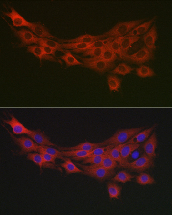 Anti-PDK1/PDHK1 Rabbit pAb