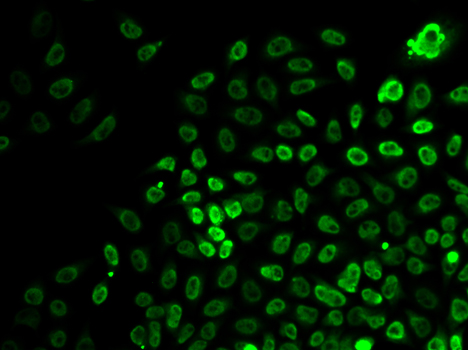 [KO Validated] Anti-BRG1 Rabbit pAb