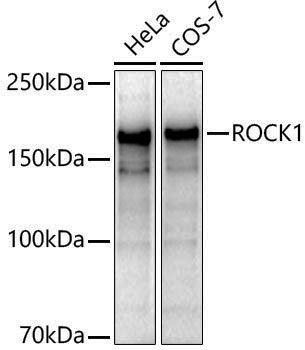 [KO Validated] Anti-ROCK1 Rabbit pAb