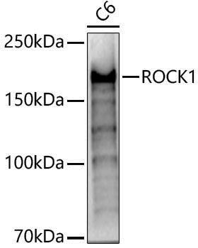 [KO Validated] Anti-ROCK1 Rabbit pAb