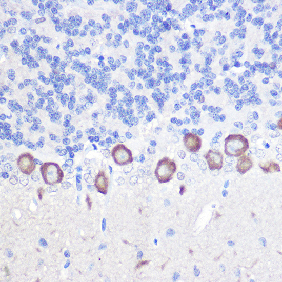 Anti-PLCB3 Rabbit pAb