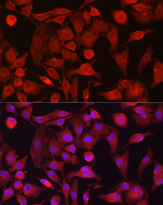 Anti-RASGRP1 Rabbit pAb
