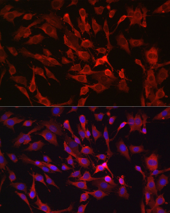 Anti-RASGRP1 Rabbit pAb