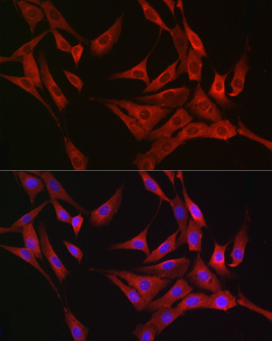 Anti-RASGRP1 Rabbit pAb