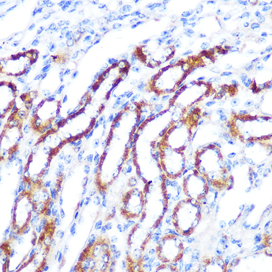Anti-SGK1 Rabbit pAb