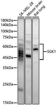 Anti-SGK1 Rabbit pAb