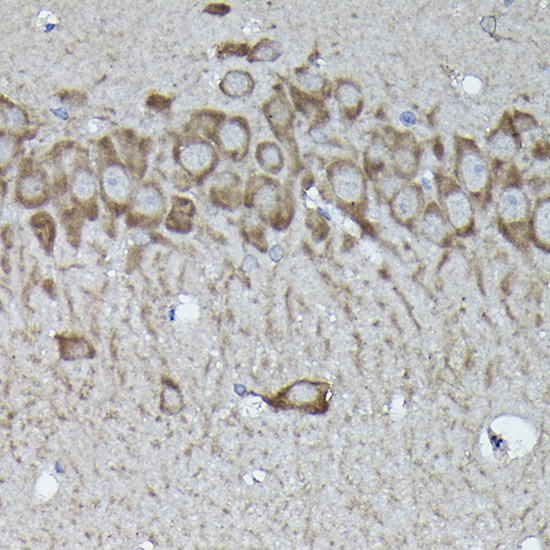 Anti-Calreticulin Rabbit pAb