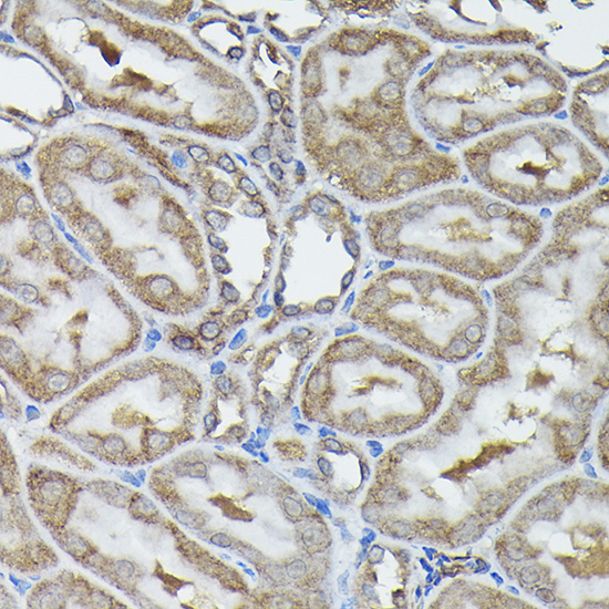 Anti-Calreticulin Rabbit pAb