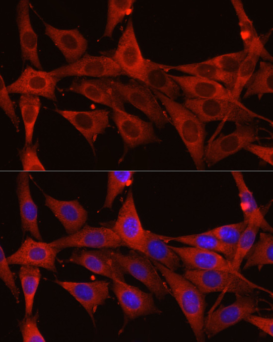 Anti-Calreticulin Rabbit pAb
