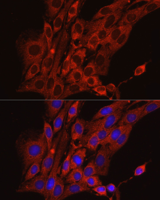 Anti-Calreticulin Rabbit pAb