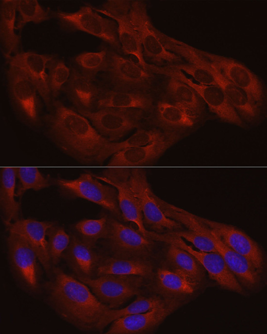 Anti-Calreticulin Rabbit pAb