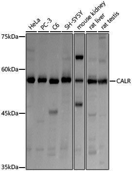Anti-Calreticulin Rabbit pAb