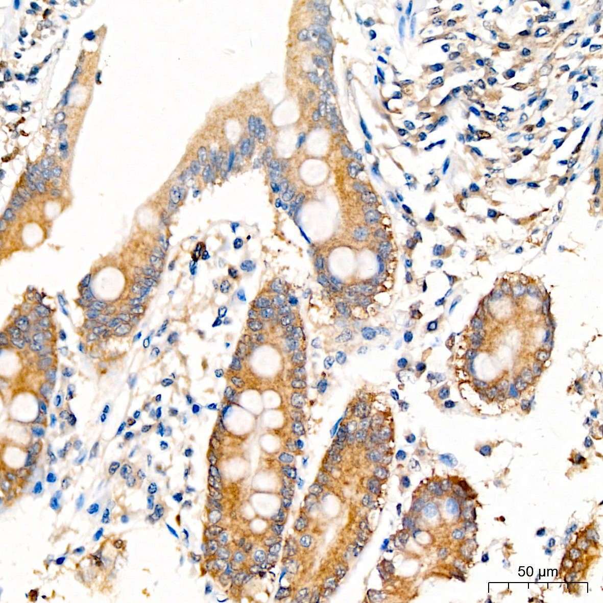 [KO Validated] Anti-Hsp90 beta Rabbit pAb
