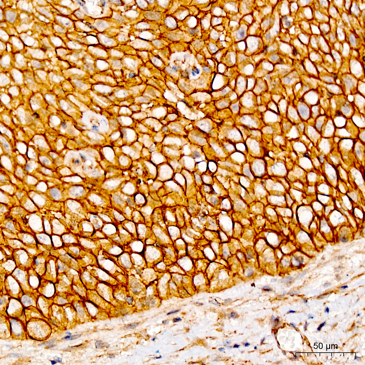 Anti-beta Catenin Rabbit pAb