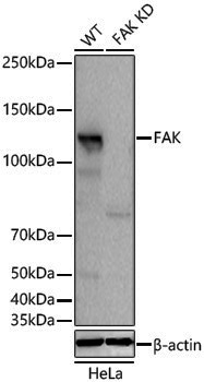 [KD Validated] Anti-FAK Rabbit pAb