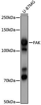 [KD Validated] Anti-FAK Rabbit pAb