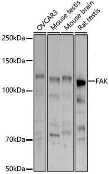 [KD Validated] Anti-FAK Rabbit pAb