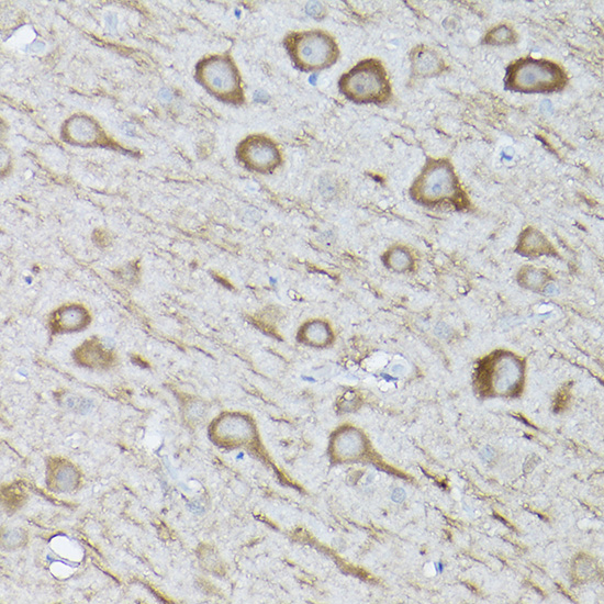 Anti-LC3B Rabbit pAb