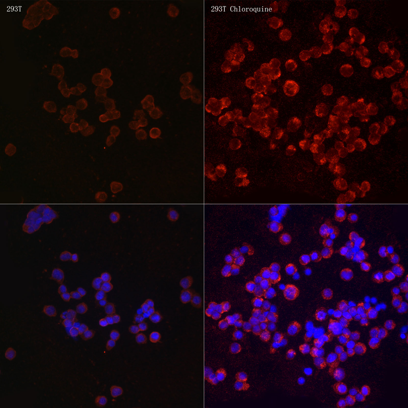 Anti-LC3B Rabbit pAb