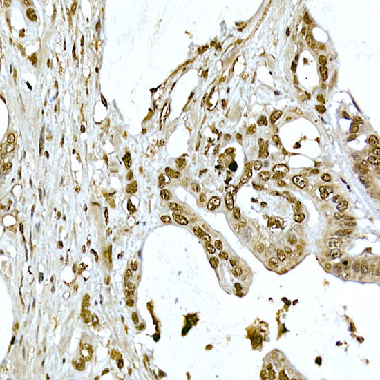 Anti-AKT1 Rabbit pAb